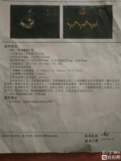 心电图检查正常心脏就没问题吗
