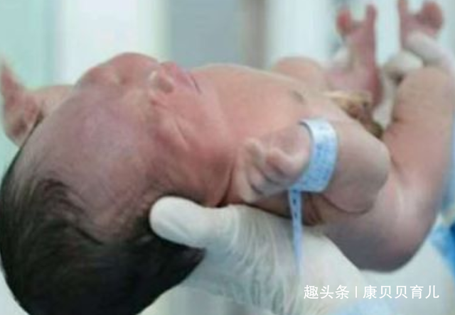 为什么会出现胎盘无法正常分娩的情况
