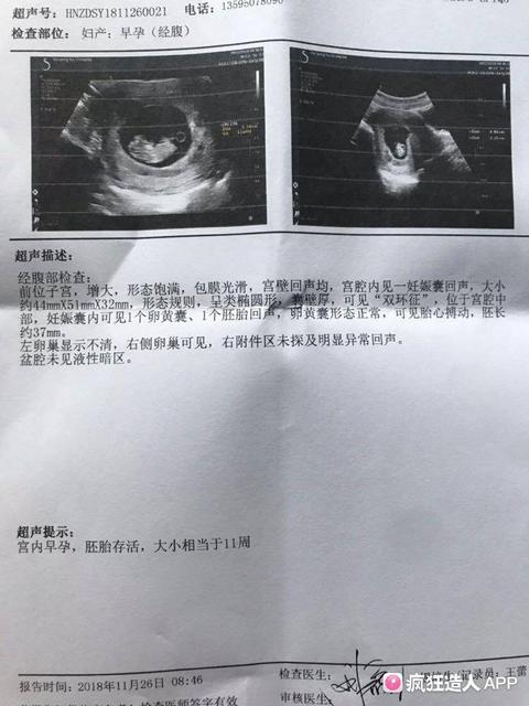 3岁以上的学前儿童,几要检查一次视力