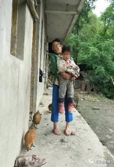 孩子被小狗咬了怎么办