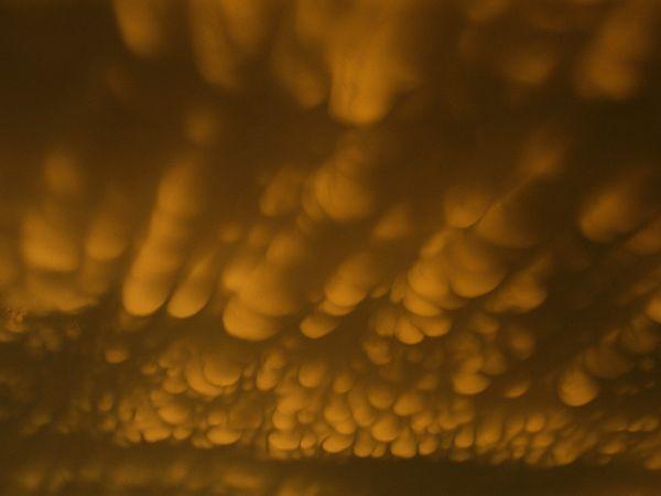 乳房的形状有哪些?