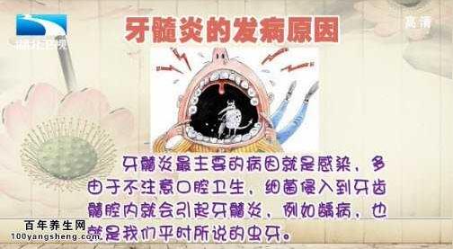 20140919饮食养生汇视频和笔记:马净值讲急性牙髓炎,牙髓炎的治疗