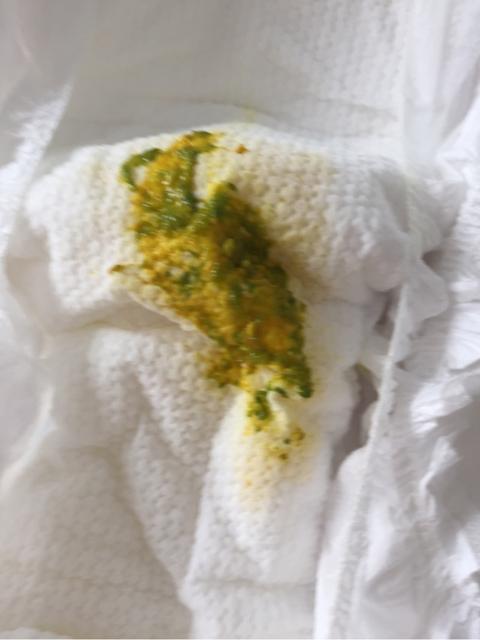新生儿常见皮肤问题如何分辨