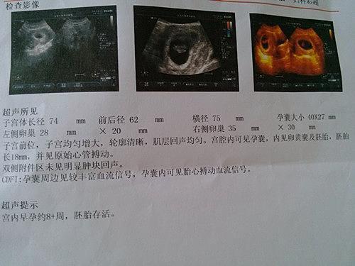 这些方法可以让你猜出宝宝性别