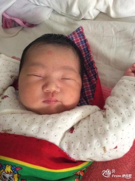 新生儿为什么会发生黄疸