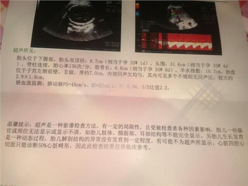 胎盘太厚是什么原因