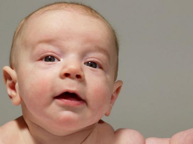 孕期怎样做孩子出生没有黄疸
