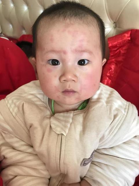 宝宝腹泻怎么看严不严重