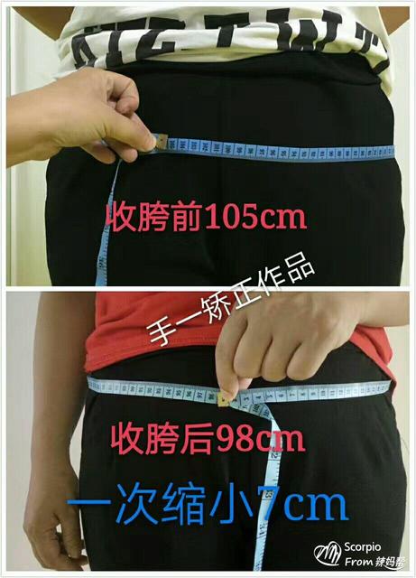 产后耻骨痛怎么办?