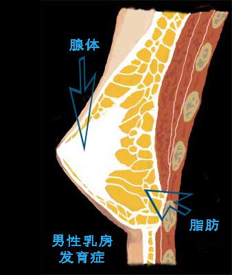 11岁的男孩乳房发育是怎么回事