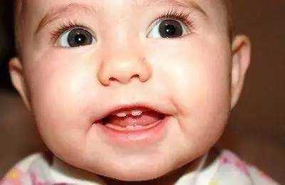 如何护理宝宝的乳牙