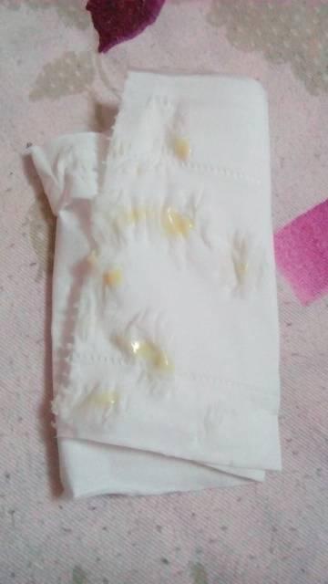 上班族的妈妈怎么保存母乳