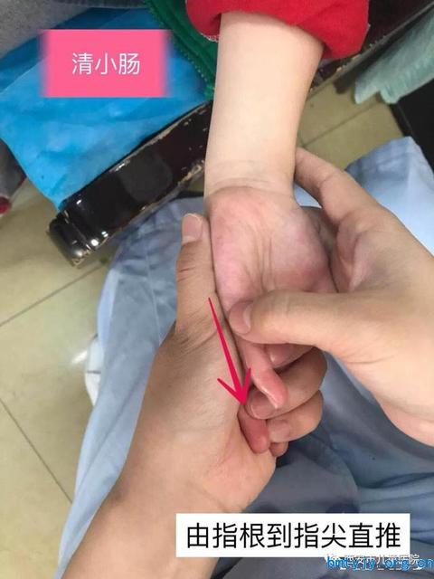 宝宝腹泻要立马止泻吗