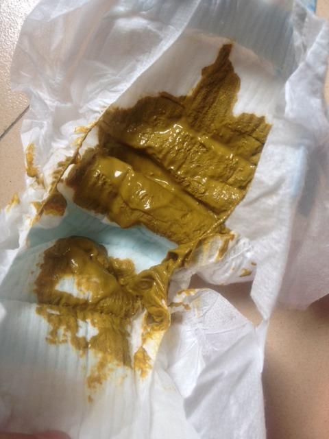 奶粉喂养的四个常见问题
