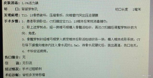 宝宝脊柱成型的关键期