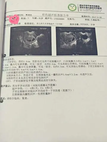 靠谱,44岁在湖南能试管婴儿么