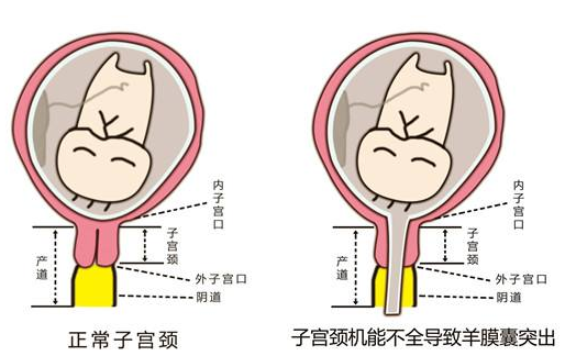 怀孕几个月查宫颈机能多少钱