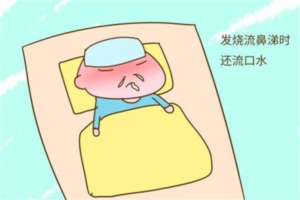 宝宝流感发烧如何推拿按摩