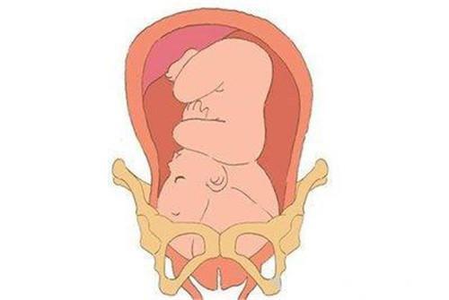胎儿入盆孕妇有什么感觉么