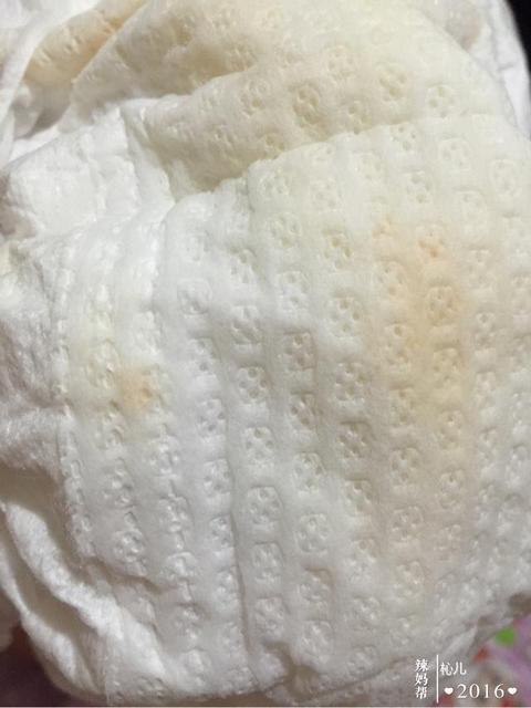 宝宝脸颊潮红是上火吗