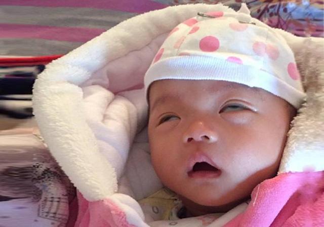 宝宝睡觉翻白眼是什么原因