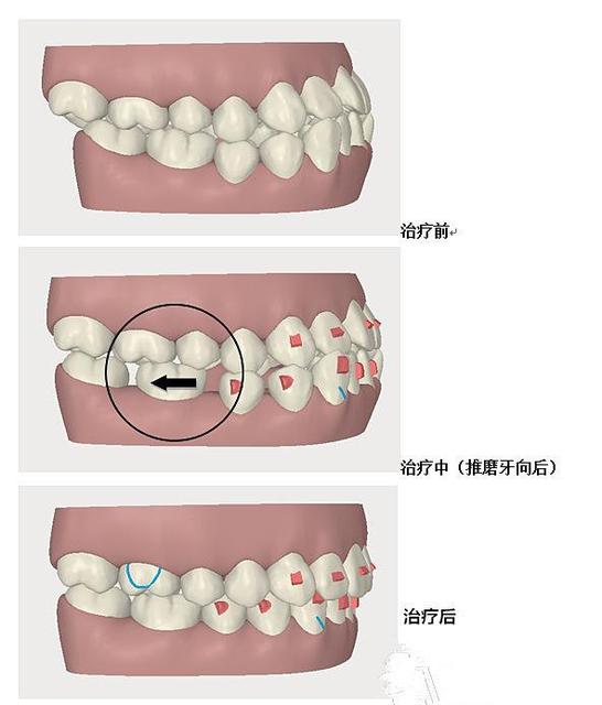 宝宝吃饭咬小勺子怎么回事