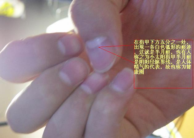 指甲上的白月牙是什么意思