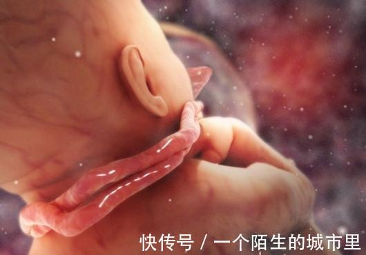 怎样预防孕妇羊水过多