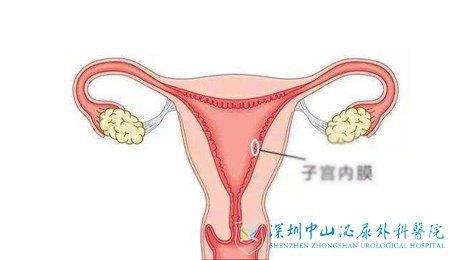 子宫内膜增厚怎么预防复发