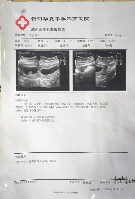 孕期做几次超声波检查