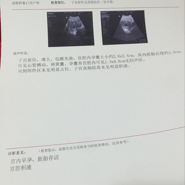 安胎最好的办法是卧床休息吗