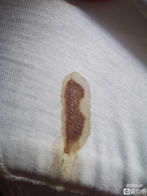 孕酮在怀孕初期有什么用