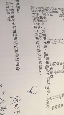 孕期前置胎盘是什么原因