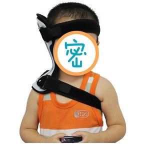 宝宝歪头一定是斜颈吗