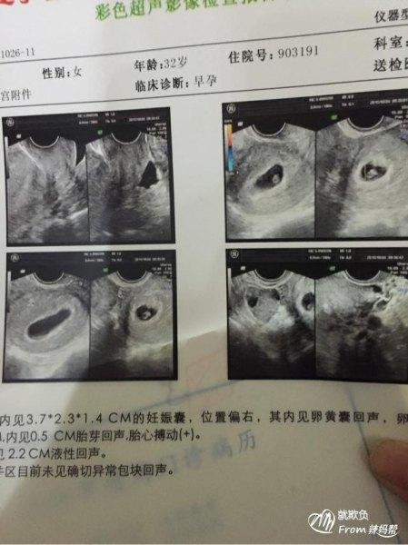 要好孕男女应该怎么做