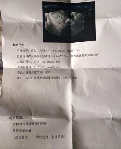 孕期非要做超声检查吗