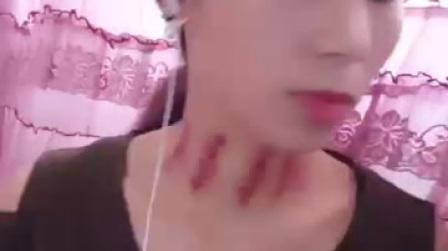 揪痧7