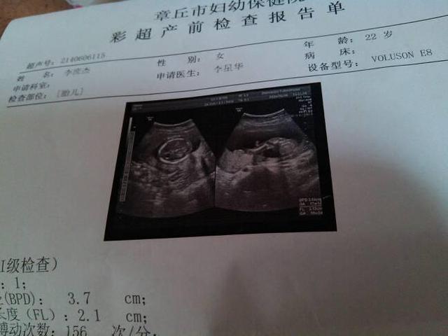 怀孕30周胎儿图片