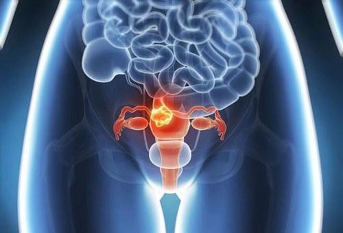 精囊炎怀孕了对胎儿有影响吗