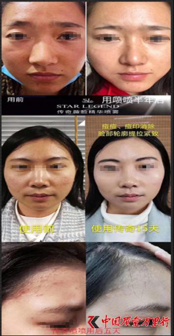 揭秘传奇微脸精华喷雾的营销骗术p图神技遭质疑