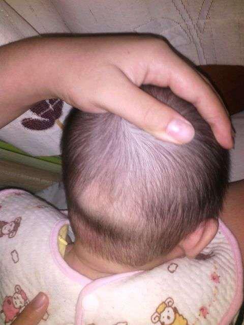 三个月宝宝不长头发是怎么回事