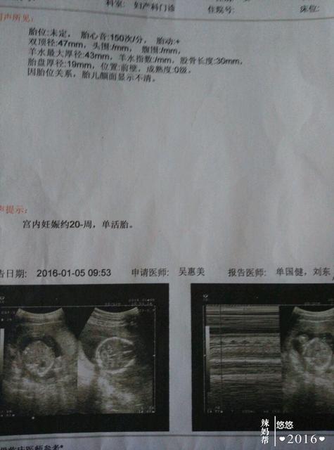 前三个月生男生女征兆