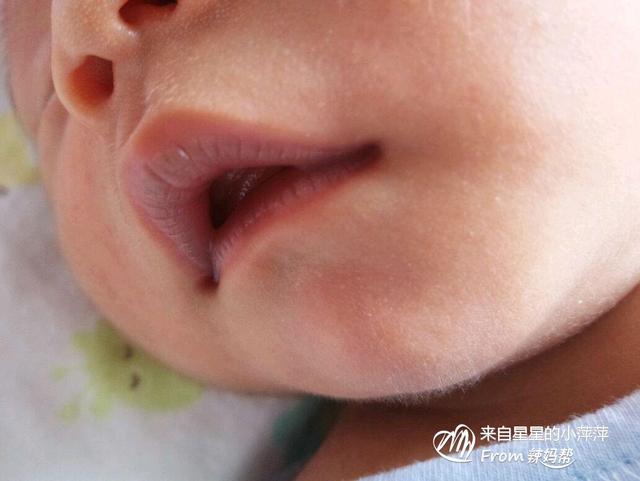 为什么宝宝哭起来嘴唇会发紫