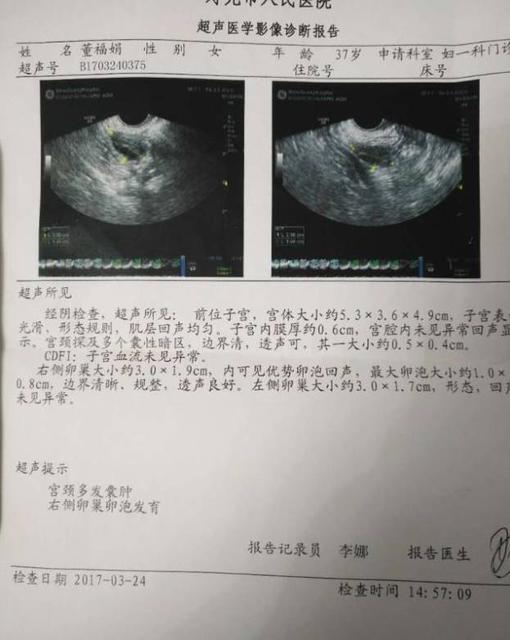 子宫检查正常月经量少