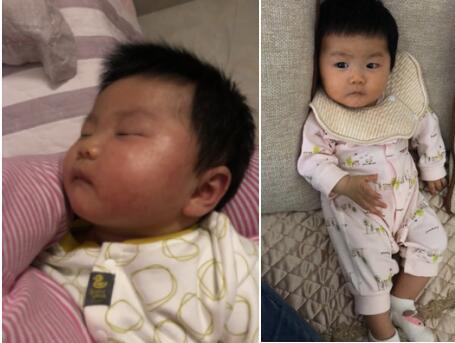 宝宝湿疹是如何引起的