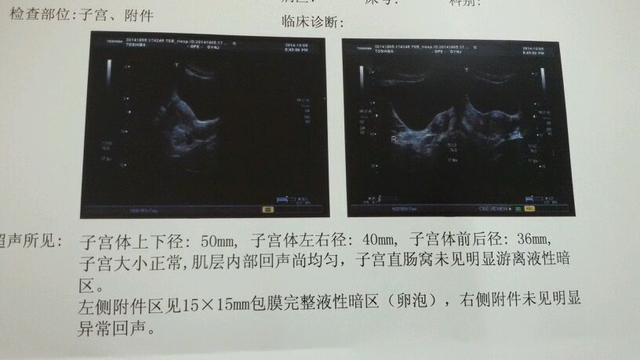 卵泡大小的正常范围是多少