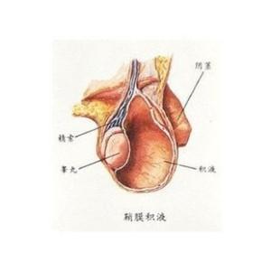 小宝宝为什么会得疝气