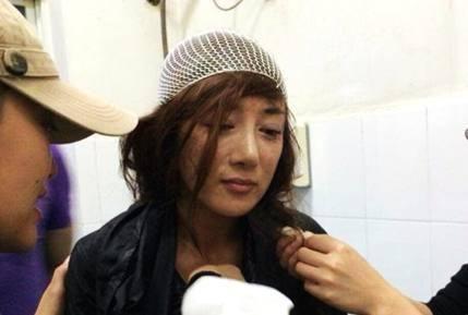 小孩被小动物咬伤了怎么办