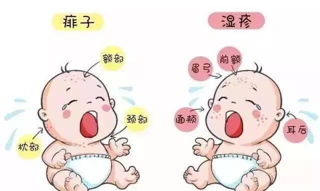 如何预防宝宝长痱子