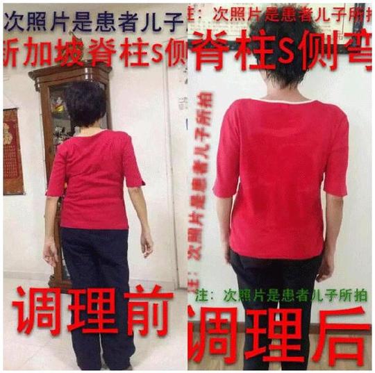 经筋骨技术就业创业培训班(初级精品班)